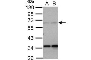 Western Blotting (WB) image for anti-Protein Phosphatase 4, Regulatory Subunit 2 (PPP4R2) (AA 1-360) antibody (ABIN1500387) (PPP4R2 anticorps  (AA 1-360))