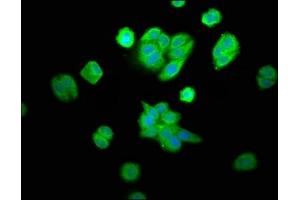 Immunofluorescence staining of HepG2 cells with ABIN7162391 at 1:100, counter-stained with DAPI.