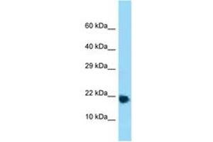 Image no. 1 for anti-Ribosomal Protein L32 (RPL32) (AA 61-110) antibody (ABIN6748313) (RPL32 anticorps  (AA 61-110))