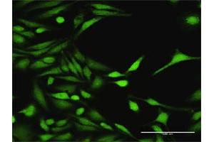 Immunofluorescence of purified MaxPab antibody to MAP3K7 on HeLa cell.