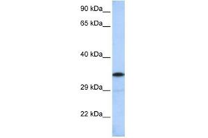 KCTD4 antibody used at 1 ug/ml to detect target protein. (KCTD4 anticorps  (Middle Region))