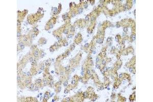 Immunohistochemistry of paraffin-embedded Human liver using MOK Polyclonal Antibody at dilution of 1:100 (40x lens). (MOK anticorps)