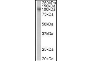 Image no. 1 for anti-ADAM Metallopeptidase Domain 8 (ADAM8) (C-Term) antibody (ABIN374195)
