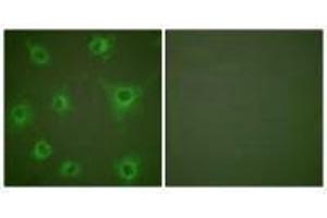 Immunofluorescence analysis of COS7 cells, using Collagen II antibody. (COL2A1 anticorps)