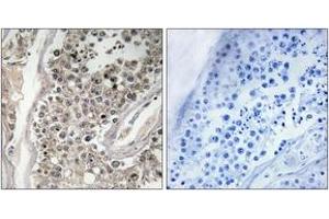 Immunohistochemistry analysis of paraffin-embedded human testis tissue, using RAB3GAP1 Antibody. (RAB3GAP1 anticorps  (AA 538-587))