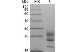 Western Blotting (WB) image for Interleukin 17A (IL17A) (Active) protein (His tag) (ABIN7321033)