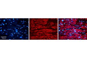 Rabbit Anti-VDAC2 Antibody   Formalin Fixed Paraffin Embedded Tissue: Human heart Tissue Observed Staining: Cytoplasmic Primary Antibody Concentration: N/A Other Working Concentrations: 1:600 Secondary Antibody: Donkey anti-Rabbit-Cy3 Secondary Antibody Concentration: 1:200 Magnification: 20X Exposure Time: 0.