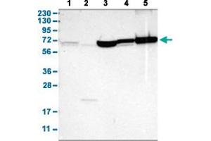 Western Blot analysis with SHOC2 polyclonal antibody . (SHoc2/Sur8 anticorps  (AA 455-562))