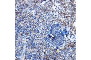 Immunohistochemistry of paraffin-embedded rat lymph node using Bax Rabbit mAb  at dilution of 1:25,1:50 (40x lens).