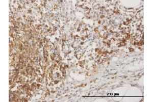 Immunoperoxidase of purified MaxPab antibody to MS4A1 on formalin-fixed paraffin-embedded human lymph node. (CD20 anticorps  (AA 1-297))
