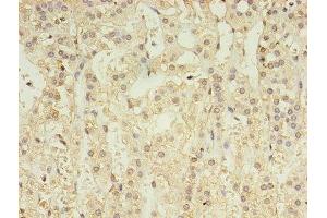 Immunohistochemistry of paraffin-embedded human adrenal gland tissue using ABIN7153483 at dilution of 1:100