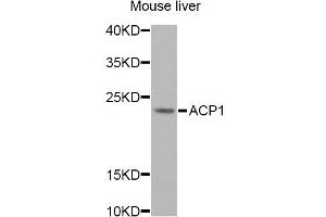 Western blot analysis of extracts of mouse liver, using ACP1 Antibody. (ACP1 anticorps)