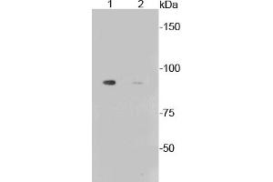 Lane 1: Aphidicolin treated Mouse liver lysates, Lane 2: Untreated Mouse Liver lysates probed with Glycogen synthase 1(S641) (10C1) Monoclonal Antibody  at 1:1000. (Glycogen Synthase 1 anticorps  (pSer641))