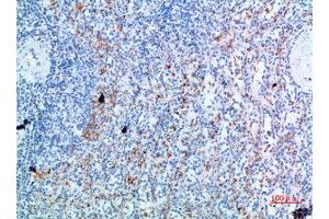 Immunohistochemical analysis of paraffin-embedded human-spleen, antibody was diluted at 1:200