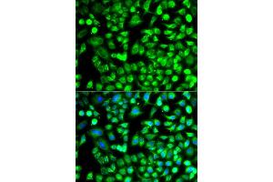 Immunofluorescence analysis of A549 cell using ALKBH4 antibody. (ALKBH4 anticorps)