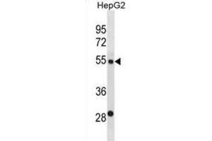 Western Blotting (WB) image for anti-ST6 beta-Galactosamide alpha-2,6-Sialyltranferase 2 (ST6GAL2) antibody (ABIN3000959) (ST6GAL2 anticorps)