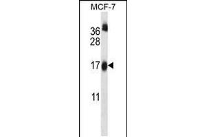 Western blot analysis in MCF-7 cell line lysates (35ug/lane). (UBE2W anticorps  (C-Term))