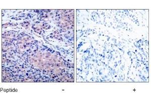 Image no. 1 for anti-Nuclear Factor of kappa Light Polypeptide Gene Enhancer in B-Cells Inhibitor, alpha (NFKBIA) (Ser32), (Ser36) antibody (ABIN197304)