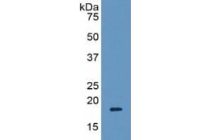 WB of Protein Standard: different control antibodies against Highly purified E. (Periostin Kit ELISA)