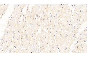 Detection of DKK2 in Human Cardiac Muscle Tissue using Monoclonal Antibody to Dickkopf Related Protein 2 (DKK2)