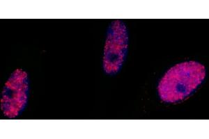 Immunofluorescence (IF) image for anti-Structural Maintenance of Chromosomes 1A (SMC1A) (pSer966) antibody (ABIN7455211) (SMC1A anticorps  (pSer966))