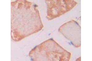 IHC-P analysis of Rat Tissue, with DAB staining. (Thrombospondin 1 anticorps  (AA 511-670))