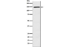 Western blot analysis of PLCG 2 expression in Ramos cell lysate.