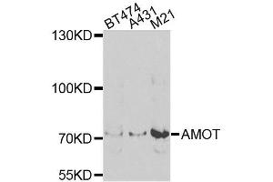 Western blot analysis of extracts of various cells, using AMOT antibody. (Angiomotin anticorps)