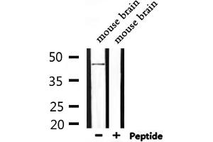 Western blot analysis of extracts from mouse brain, using NMUR1 Antibody. (NMUR1 anticorps  (N-Term))