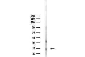 Western blot analysis of lysates from  cells(starvation 24h treatment), using ZFAN Antibody at 1/1000 dilution.
