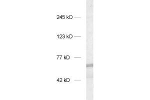 dilution: 1 : 1000, sample: rat brain homogenate (INA anticorps)