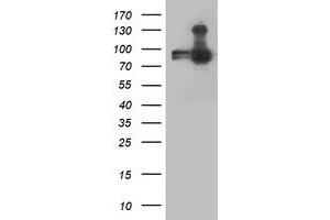 Western Blotting (WB) image for anti-Anaphase Promoting Complex Subunit 2 (ANAPC2) antibody (ABIN1496638) (ANAPC2 anticorps)