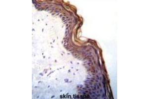 Immunohistochemistry (IHC) image for anti-Kallikrein 7 (KLK7) antibody (ABIN3002618) (Kallikrein 7 anticorps)