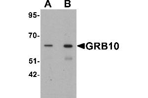 Western blot analysis of GRB10 in SK-N-SH cell lysate with GRB10 antibody at (A) 1 and (B) 2 µg/mL.