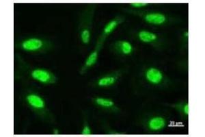 Immunostaining analysis in HeLa cells.