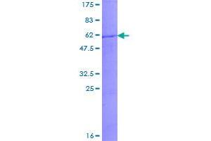 Image no. 1 for Kallikrein 5 (KLK5) (AA 1-293) protein (GST tag) (ABIN1308862)