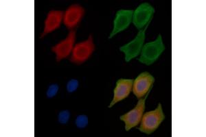 ABIN6259817 and ABIN6268680 staining Hela cells(45 min of heat-shock treatment) by IF/ICC. (alpha Fetoprotein anticorps  (C-Term))