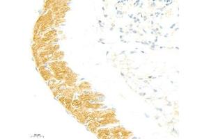Immunohistochemistry of paraffin embedded mouse lung using collagen alpha-1 (V) (ABIN7073547) at dilution of 1: 1800 (400x lens) (Collagen Type V anticorps)
