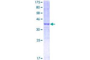 Image no. 1 for Nuclear Receptor Coactivator 3 (NCOA3) (AA 251-360) protein (GST tag) (ABIN1312128)