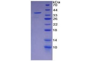 SDS-PAGE of Protein Standard from the Kit  (Highly purified E. (ENO2/NSE Kit ELISA)