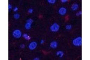 Immunofluorescence analysis of Rat liver tissue using Phospho-Pan-Akt (Ser473) Polyclonal Antibody at dilution of 1:200 (AKT1 anticorps  (pSer473))
