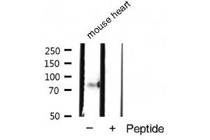 Western blot analysis of Phospho-STAT4 (Tyr693) expression in Mouse heart tissue lysate