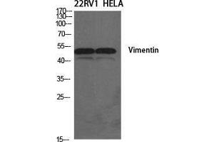 Western Blot (WB) analysis of specific cells using Vimentin Polyclonal Antibody. (Vimentin anticorps  (Tyr317))