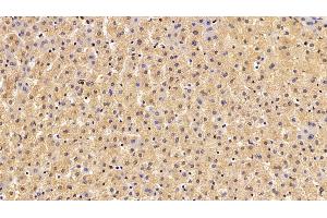 Detection of F8 in Porcine Liver Tissue using Polyclonal Antibody to Coagulation Factor VIII (F8)