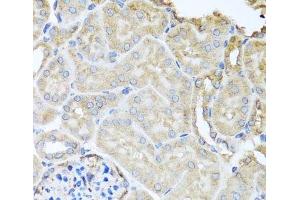 Immunohistochemistry of paraffin-embedded Mouse kidney using MYLK Polyclonal Antibody at dilution of 1:100 (40x lens). (MYLK anticorps)