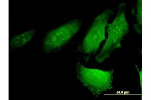Immunofluorescence of monoclonal antibody to RERG on HeLa cell.