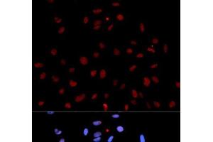 Immunofluorescence analysis of U2OS cells using Phospho-MET(Y1235) Polyclonal Antibody (c-MET anticorps  (pTyr1235))