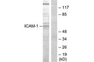 Western blot analysis of extracts from HepG2 cells, using ICAM-1 (Ab-512) Antibody. (ICAM1 anticorps  (AA 479-528))