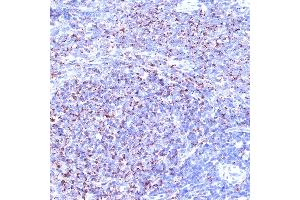 Immunohistochemistry of paraffin-embedded rat spleen using TC10/RHOQ Rabbit mAb (ABIN7269869) at dilution of 1:100 (40x lens). (RHOQ anticorps)