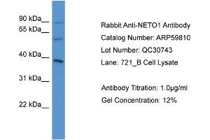 WB Suggested Anti-NETO1  Antibody Titration: 0.